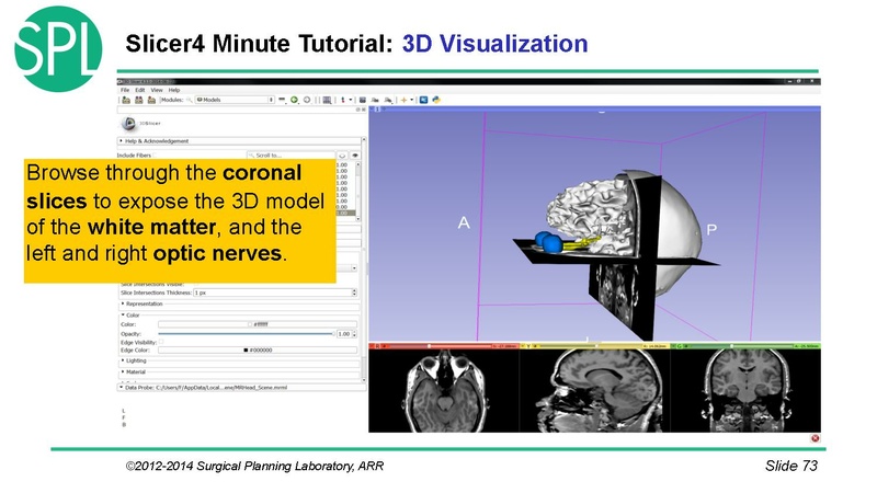 File:3DVisualizationDICOM SoniaPujol.pdf