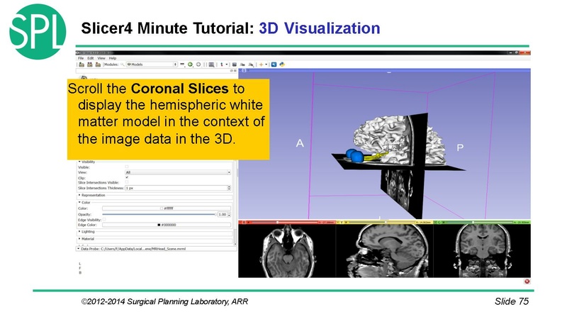 File:3DVisualizationDICOM SoniaPujol.pdf