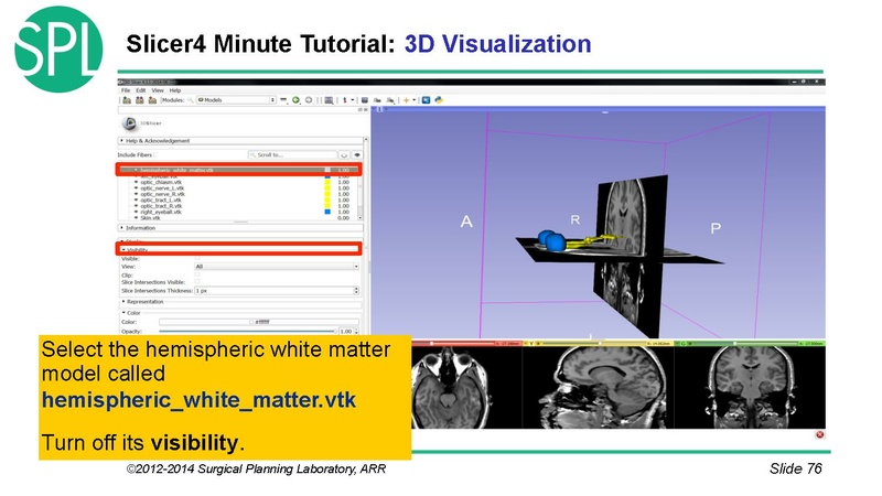 File:3DVisualizationDICOM SoniaPujol.pdf