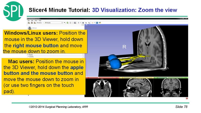 File:3DVisualizationDICOM SoniaPujol.pdf