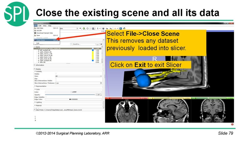 File:3DVisualizationDICOM SoniaPujol.pdf