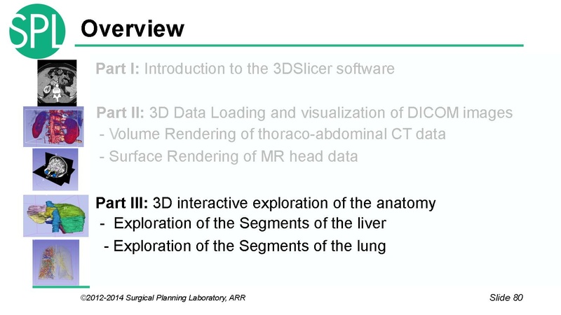 File:3DVisualizationDICOM SoniaPujol.pdf