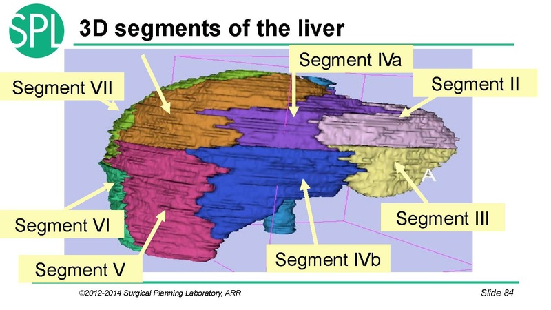 File:3DVisualizationDICOM SoniaPujol.pdf