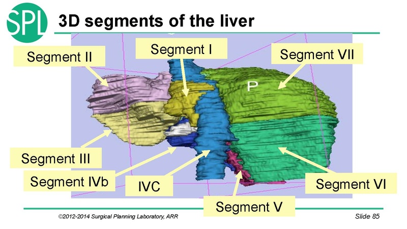 File:3DVisualizationDICOM SoniaPujol.pdf
