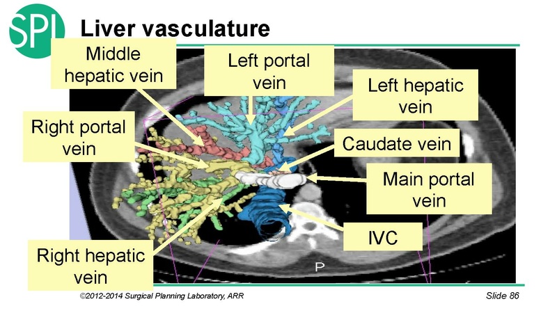 File:3DVisualizationDICOM SoniaPujol.pdf