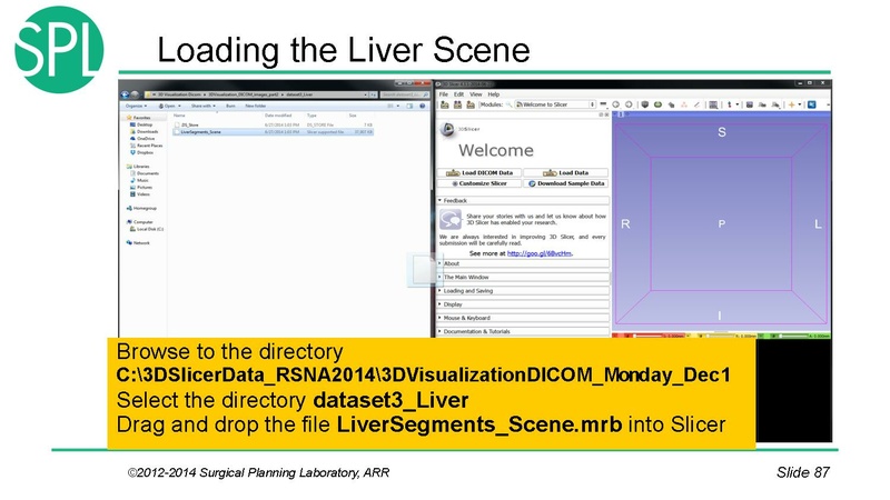 File:3DVisualizationDICOM SoniaPujol.pdf