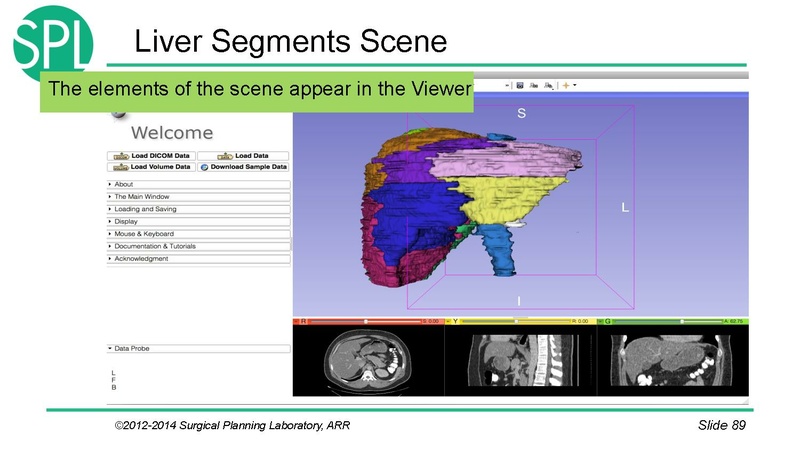 File:3DVisualizationDICOM SoniaPujol.pdf