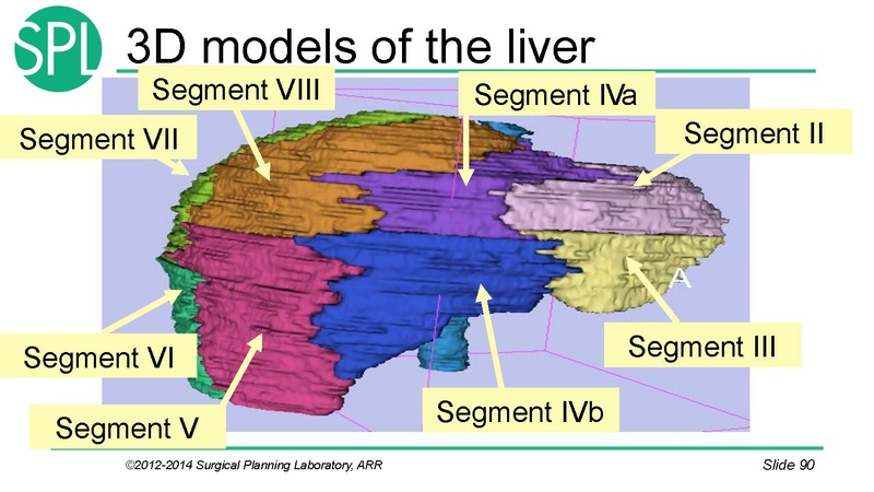 File:3DVisualizationDICOM SoniaPujol.pdf
