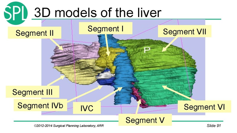 File:3DVisualizationDICOM SoniaPujol.pdf