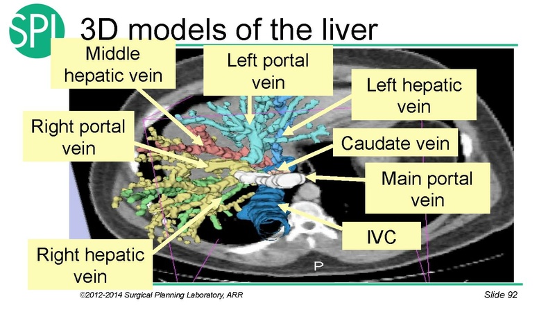 File:3DVisualizationDICOM SoniaPujol.pdf
