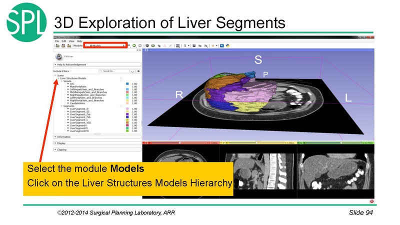 File:3DVisualizationDICOM SoniaPujol.pdf