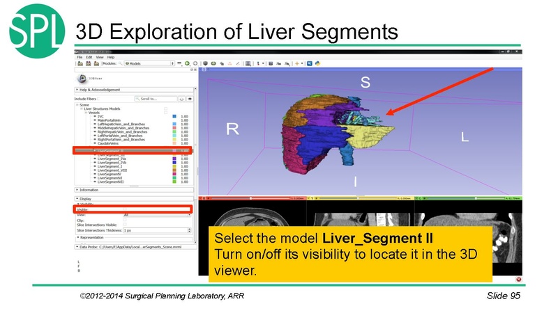 File:3DVisualizationDICOM SoniaPujol.pdf