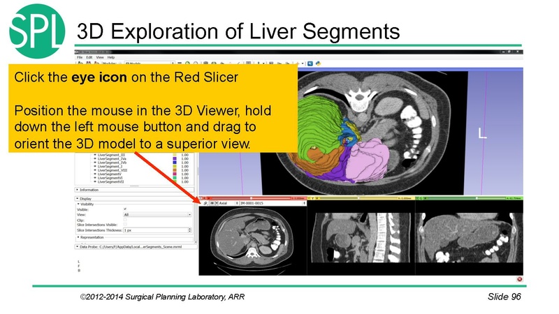 File:3DVisualizationDICOM SoniaPujol.pdf