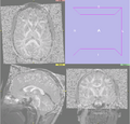 Thumbnail for version as of 22:25, 19 May 2008