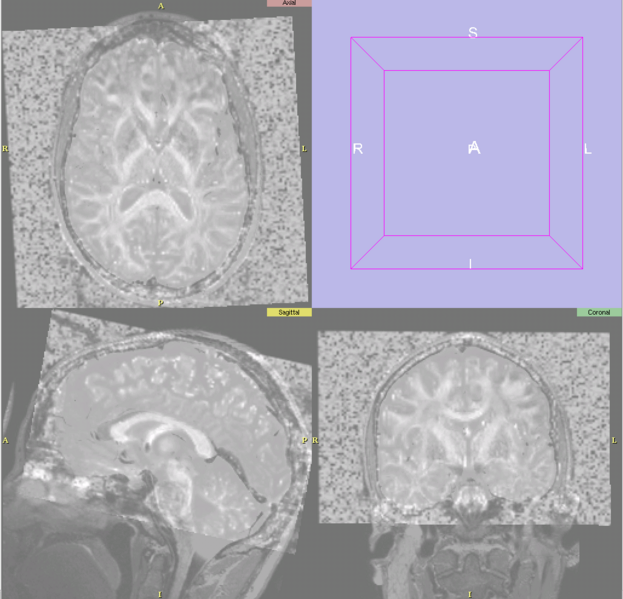 File:T2-FA-registration-slicer2-2008-04-08.png
