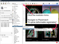 PlastimatchTutorial Winter2016Contest.png