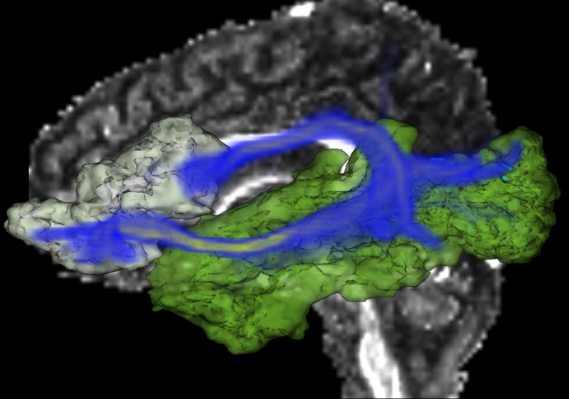 File:Stochastic-Tractography-01040-lh-all-3D-cropped.png