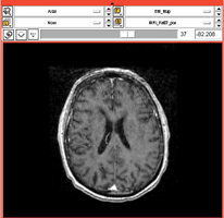 EMSegment PETCT Physiology-1.png