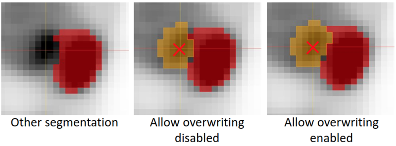 File:PETTumorSegmentation OptionAllowOverwriting.png