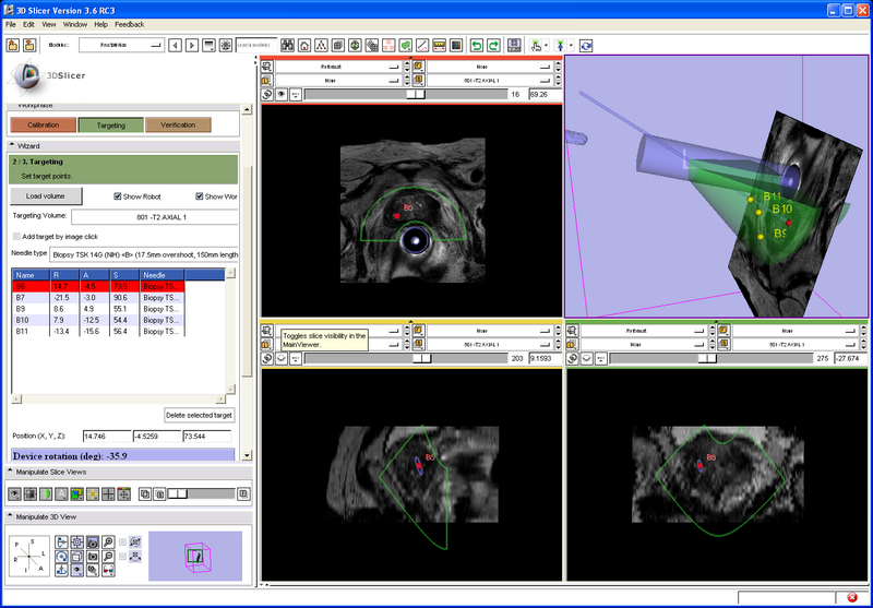 File:ProstateNav-3.6 Transrectal.png