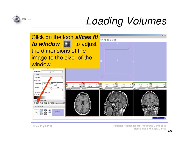 File:Slicer3Course DataLoadingAndVisualization SoniaPujol.pdf