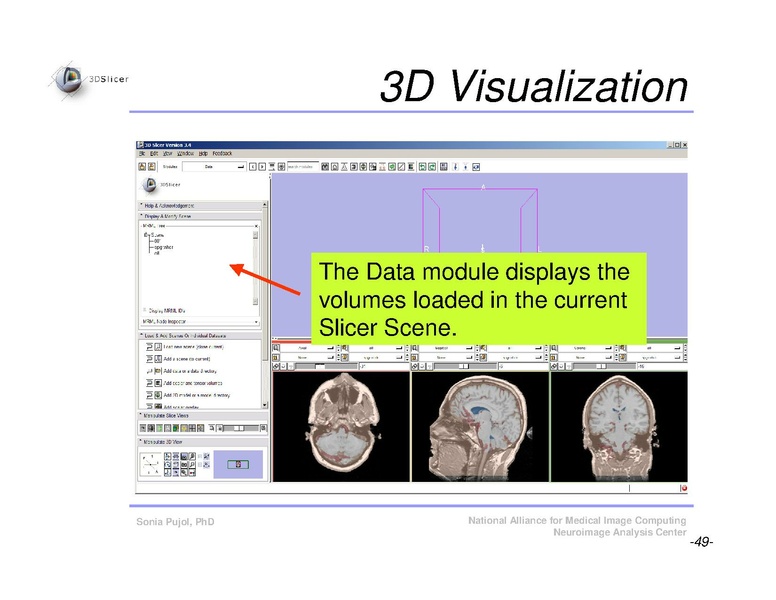 File:Slicer3Course DataLoadingAndVisualization SoniaPujol.pdf
