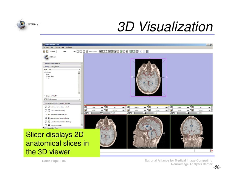 File:Slicer3Course DataLoadingAndVisualization SoniaPujol.pdf