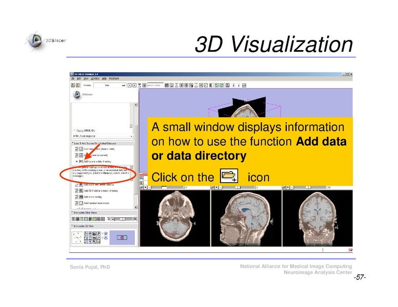 File:Slicer3Course DataLoadingAndVisualization SoniaPujol.pdf