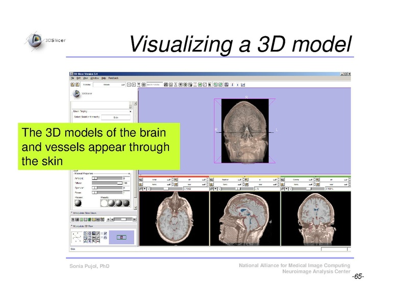 File:Slicer3Course DataLoadingAndVisualization SoniaPujol.pdf