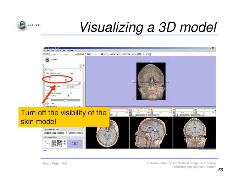 File:Slicer3Course DataLoadingAndVisualization SoniaPujol.pdf