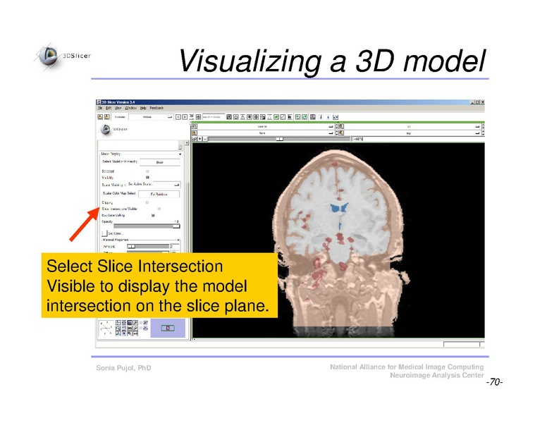 File:Slicer3Course DataLoadingAndVisualization SoniaPujol.pdf