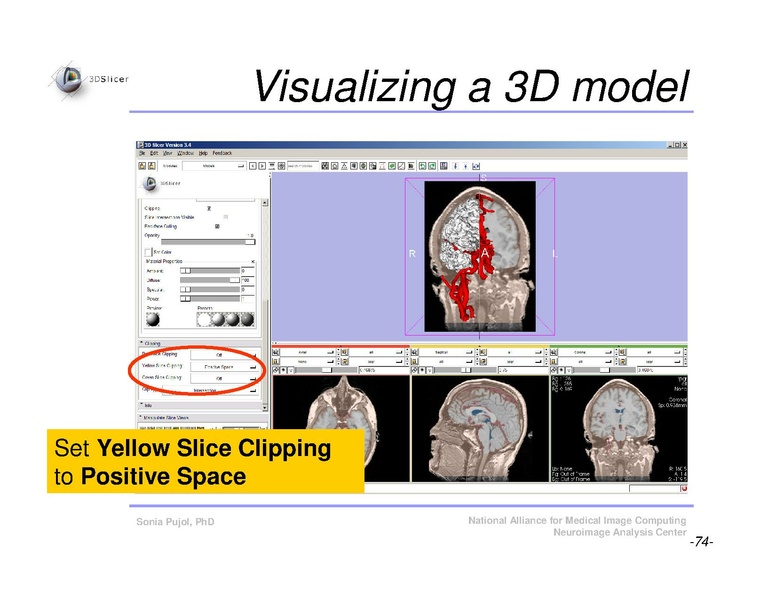 File:Slicer3Course DataLoadingAndVisualization SoniaPujol.pdf