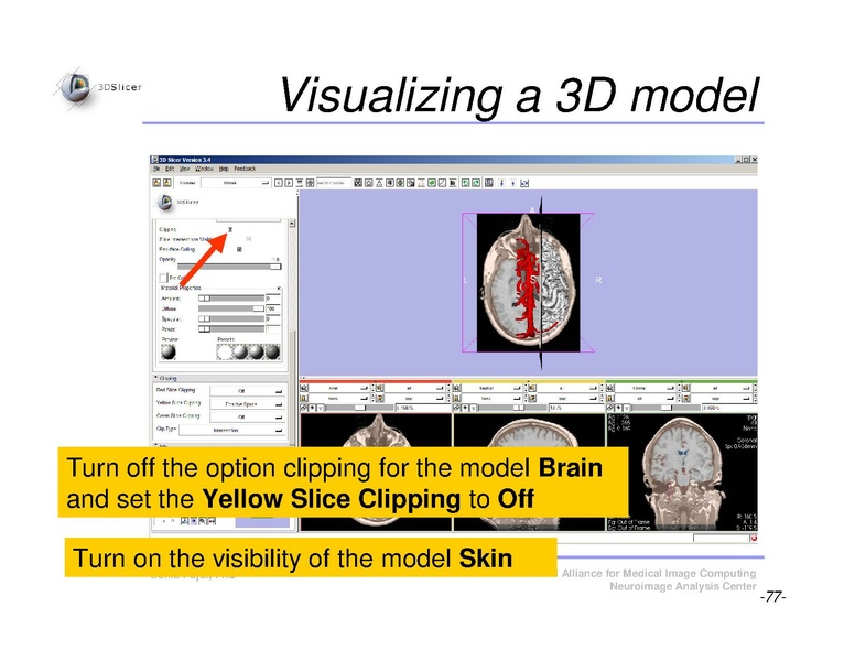File:Slicer3Course DataLoadingAndVisualization SoniaPujol.pdf