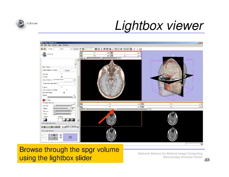 File:Slicer3Course DataLoadingAndVisualization SoniaPujol.pdf