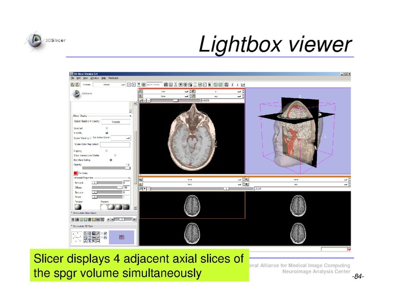 File:Slicer3Course DataLoadingAndVisualization SoniaPujol.pdf