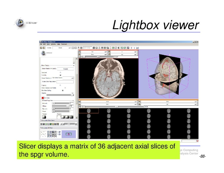 File:Slicer3Course DataLoadingAndVisualization SoniaPujol.pdf