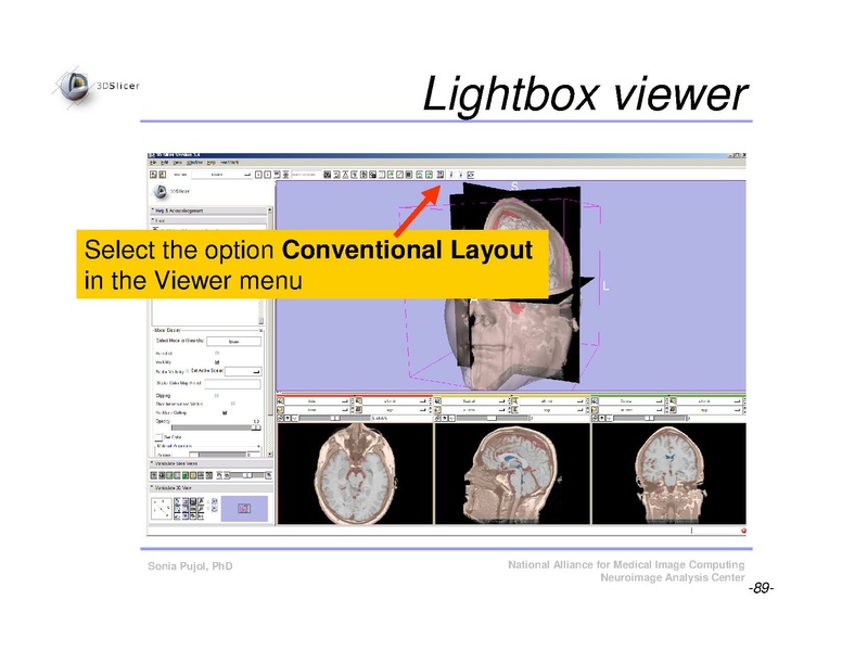 File:Slicer3Course DataLoadingAndVisualization SoniaPujol.pdf