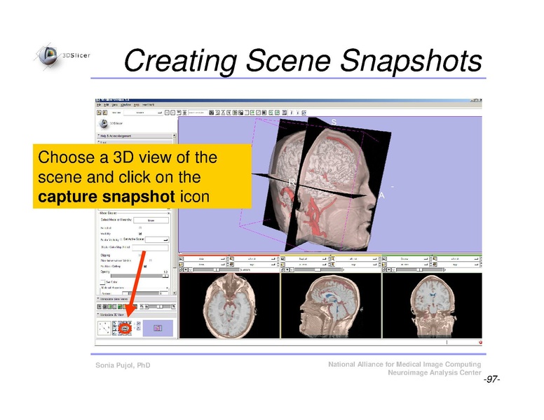 File:Slicer3Course DataLoadingAndVisualization SoniaPujol.pdf