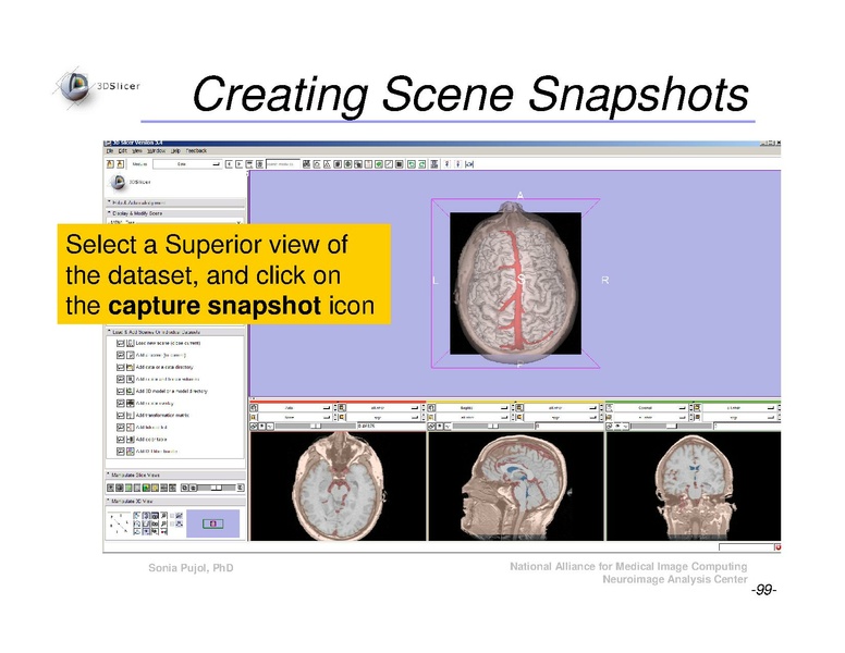 File:Slicer3Course DataLoadingAndVisualization SoniaPujol.pdf