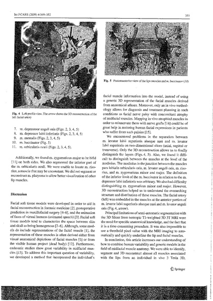 File:Olszewski-IJCARS2009.pdf
