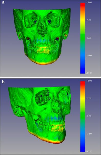 File:Ponce-Garcia-Head Face Med. 2020-FIG4.jpg