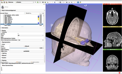 Slicer4Minute tutorial