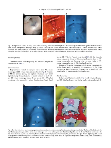 File:Nakajima-Neuroimage2007.pdf
