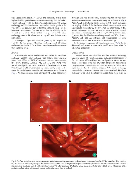 File:Nakajima-Neuroimage2007.pdf