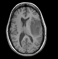 RegLib C09: fMRI to T1