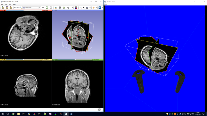 File:SlicerVirtualReality Screenshot1.png