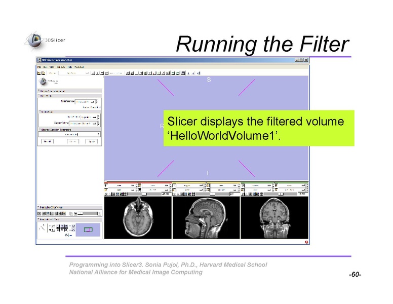 File:ProgrammingIntoSlicer3 SoniaPujol-draft.pdf