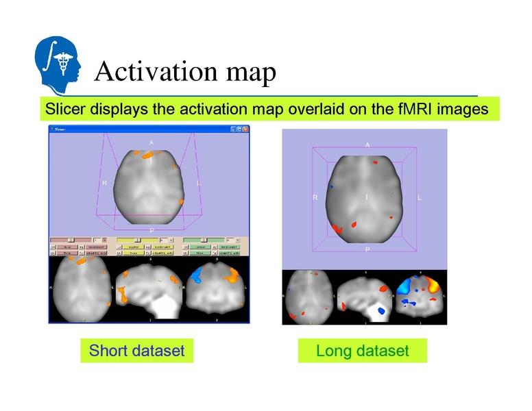 File:SlicerTraining5 fMRI.pdf