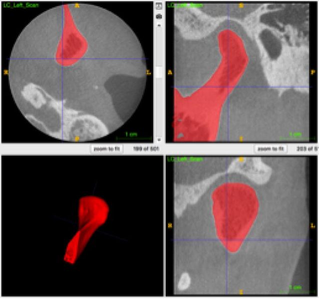 File:DeDumast-SPIE-OptEng2018-fig4.jpg