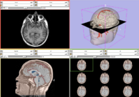 DataLoadingAndVisualization SPujol.png